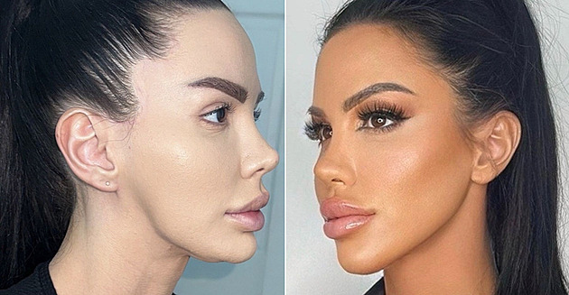 Honba za dokonalostí ženu stála spoustu peněz a málem i život